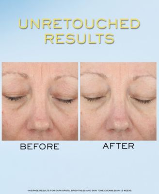 UV Expert Supra Screen Invisible Sunscreen Serum SPF 50