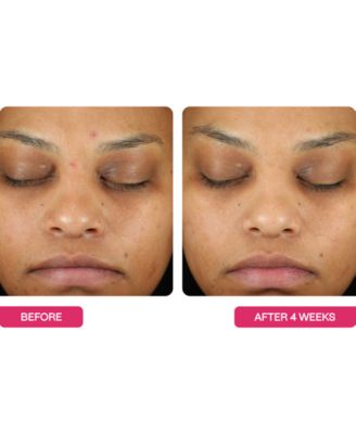 Universal Triple Action Daily Peel Pads, 10-Pk.