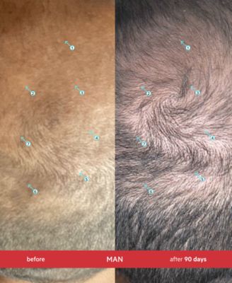 Revita Extra Strength Hair Density Shampoo, 205 ml