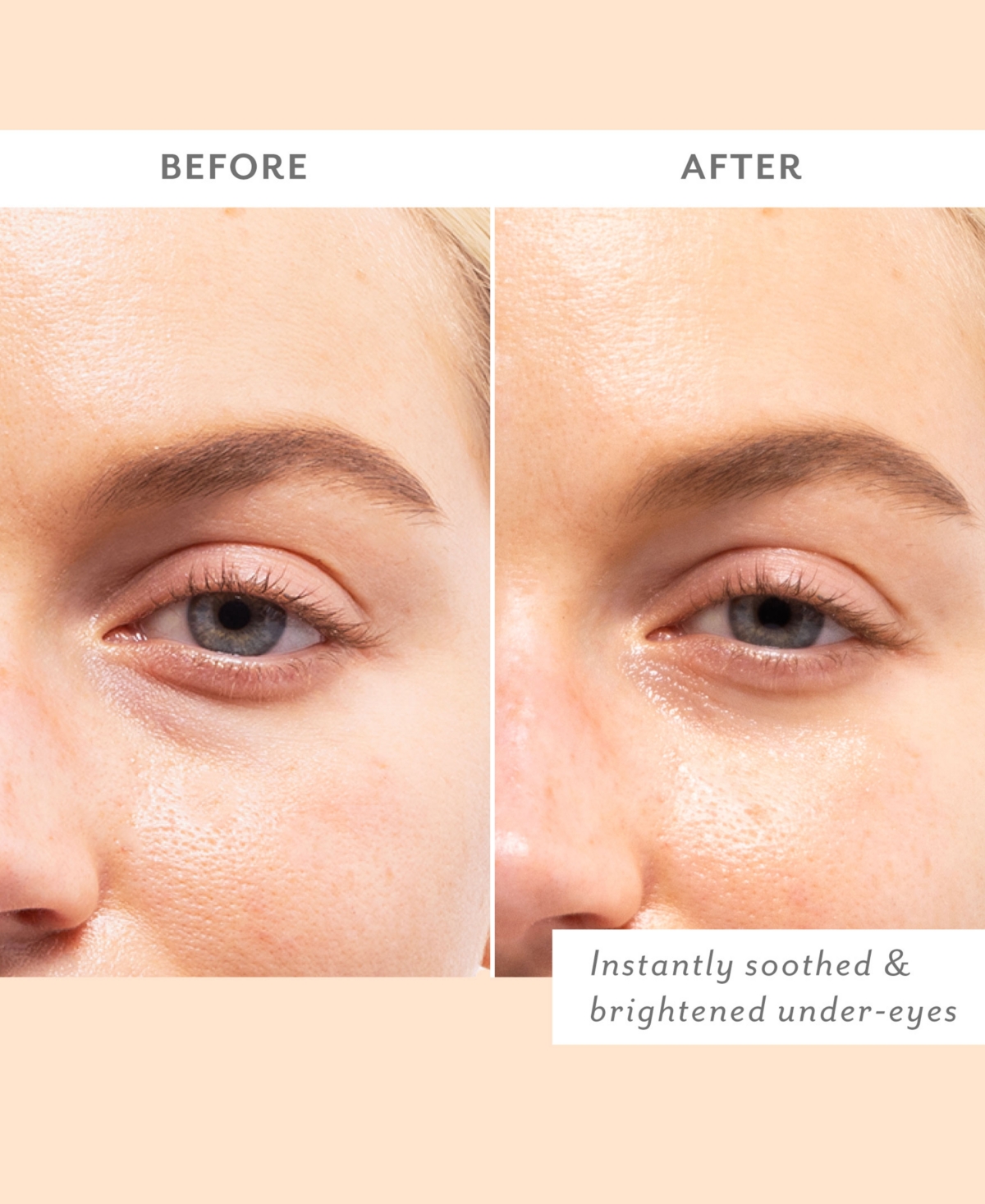 Patchology Skin Remedy Soothing Eye Gels