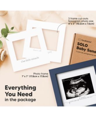 Solo Baby Sonogram Picture Frame, Modern Ultrasound Picture Frames, Pregnancy Announcements Sonogram Frame