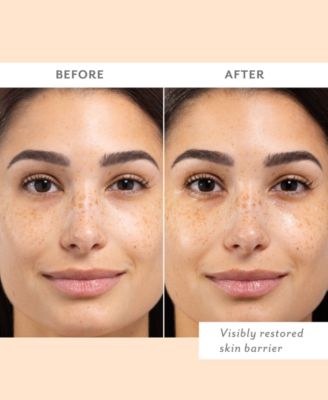 Skin Remedy Barrier-Boosting Sheet Mask, 4-Pk.