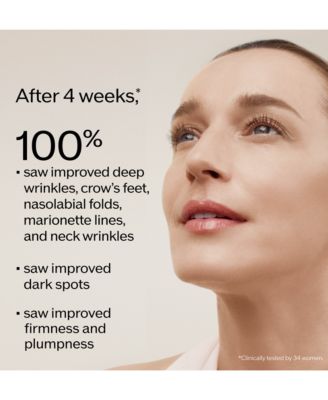 Vital Perfection Intensive WrinkleSpot Treatment A+, 1 oz.