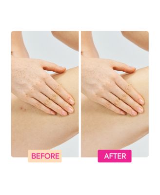 Ginger Extract + Tranexamic Acid + Retinol Body Toning Cream