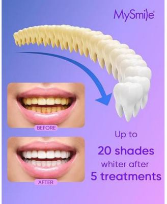 4Pcs 35% Non-Sensitive Teeth Whitening Gel Refill Pack Kit for Whitening Teeth, Mint Flavor Teeth Whitener (Not Include LED Mouth Tray)