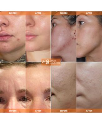 Korean Skin Care Multi-Function All-In-One Anti-Aging Snail Mucin Repair Cream 4 oz. K Beauty Skincare