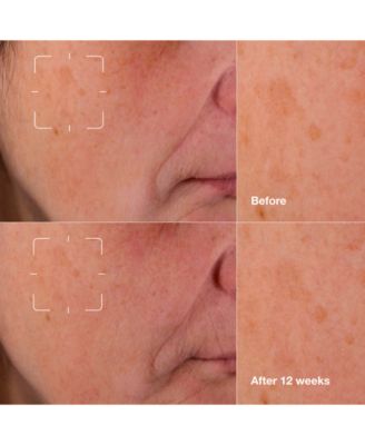 3-Pc. Brightening Routine: Mini Even Better Skincare Kit