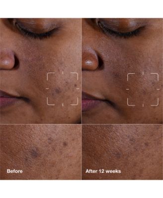 3-Pc. Brightening Routine: Mini Even Better Skincare Kit