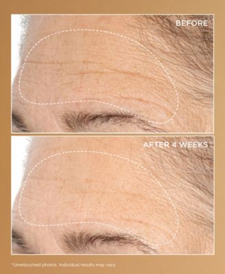 Neuropeptide Deep Crease Serum, 1 oz.