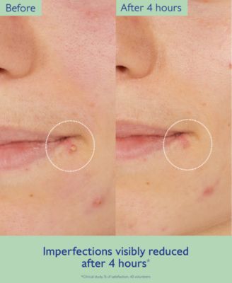 Vinopure Pore Purifying Gel Cleanser, 5 oz.