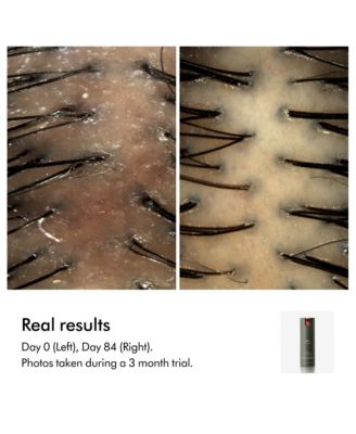 Amino Leave-in Scalp Bubble Treatment