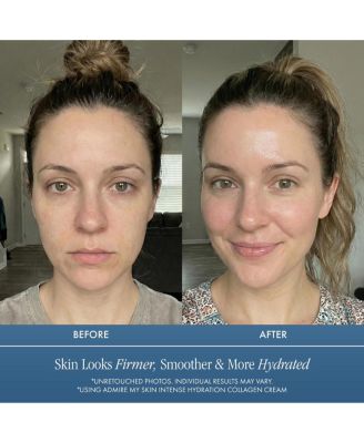 Intense Hydration Collagen Cream Hyaluronic Acid Anti Aging Moisturizer