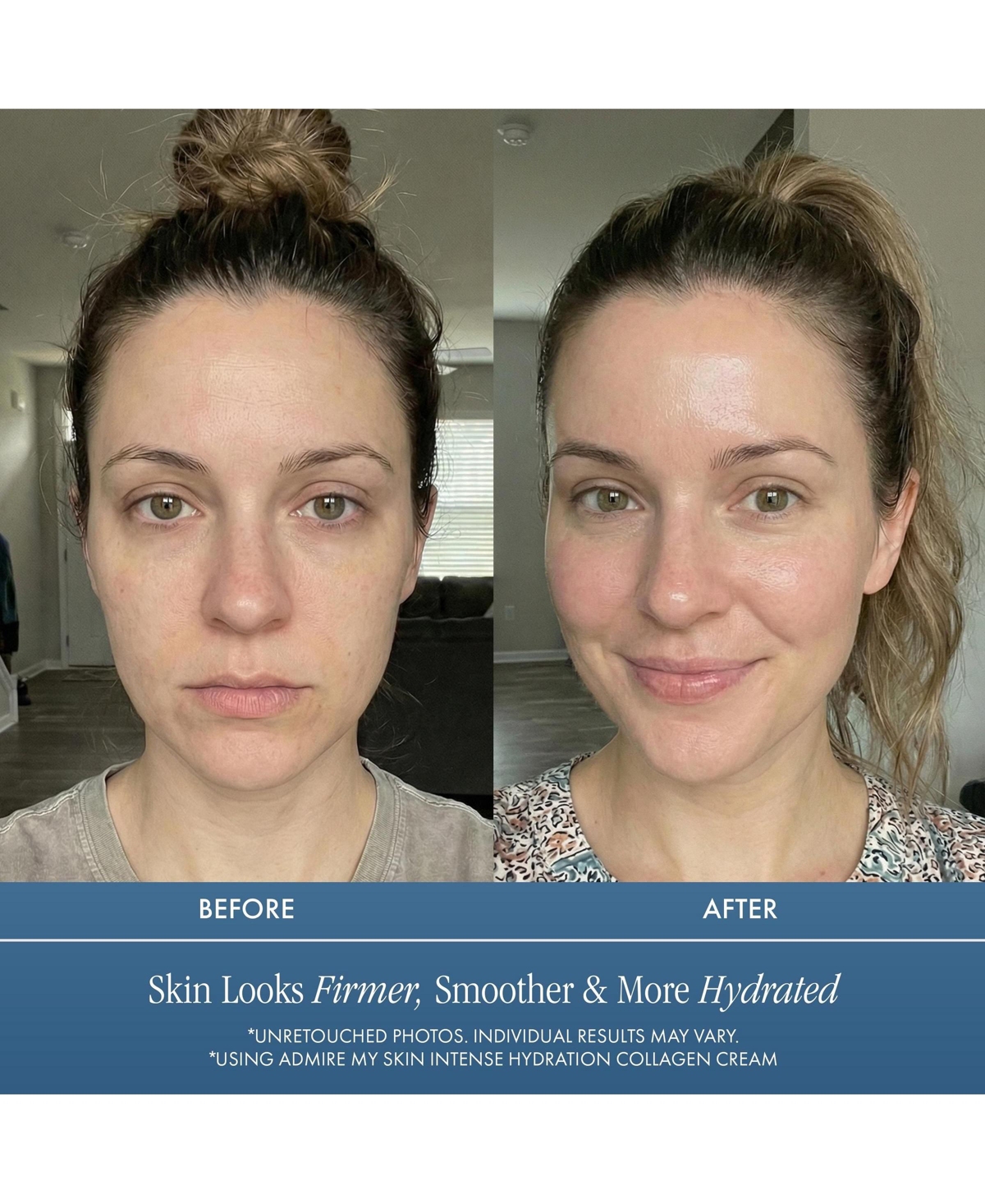 Admire My Skin Intense Hydration Collagen Cream for Anti Aging Anti Wrinkle Cream