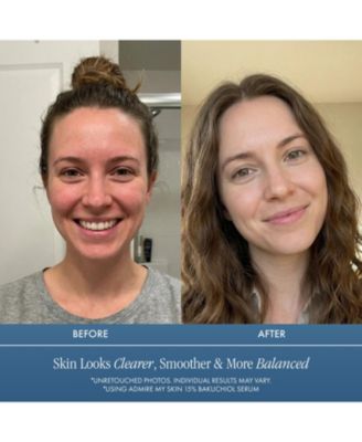 15% Bakuchiol Serum Natural Retinol Alternative