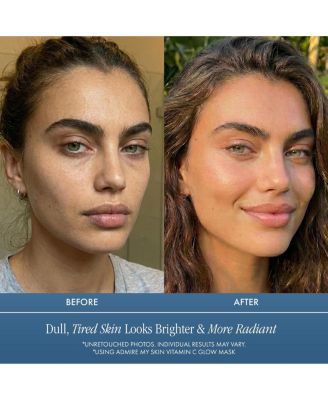 Vitamin C Glow Mask for Brightening - Contains Glycolic and Lactic Acids