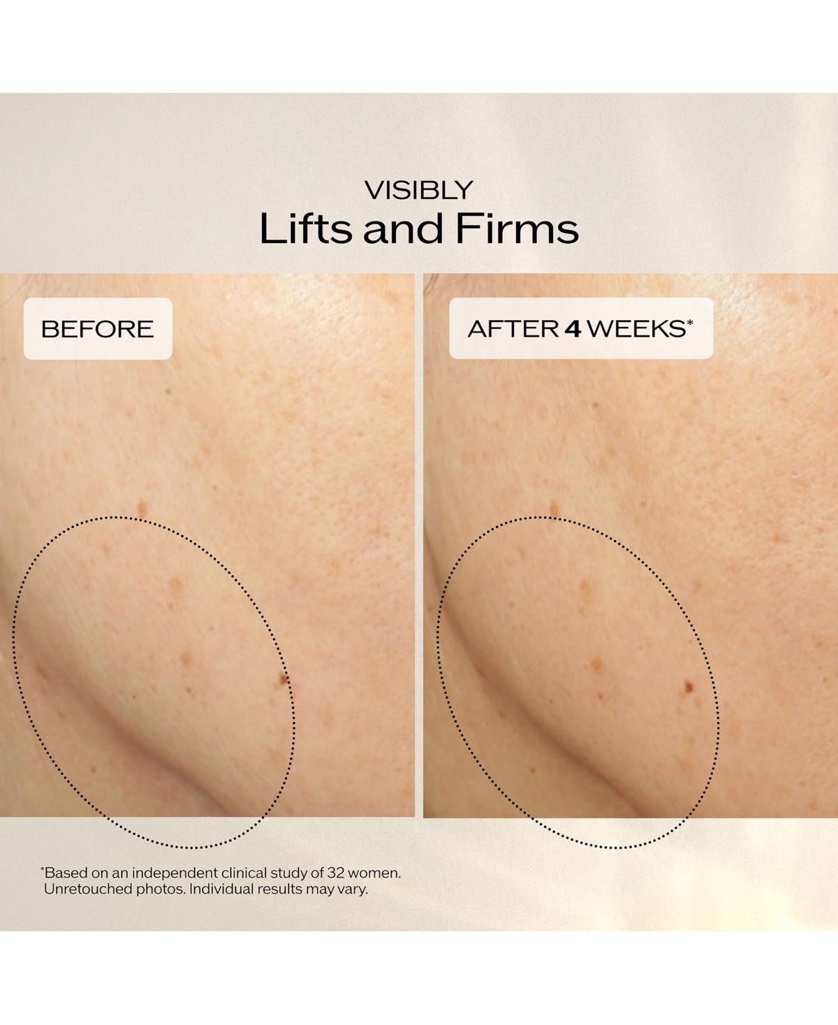 Shiseido 5-Piece Vital Perfection Advanced Lifting & Firming Cream Set